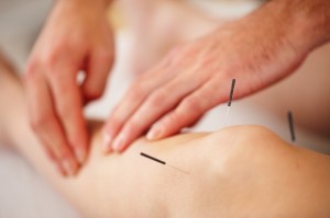 Acupuncture for knee injury