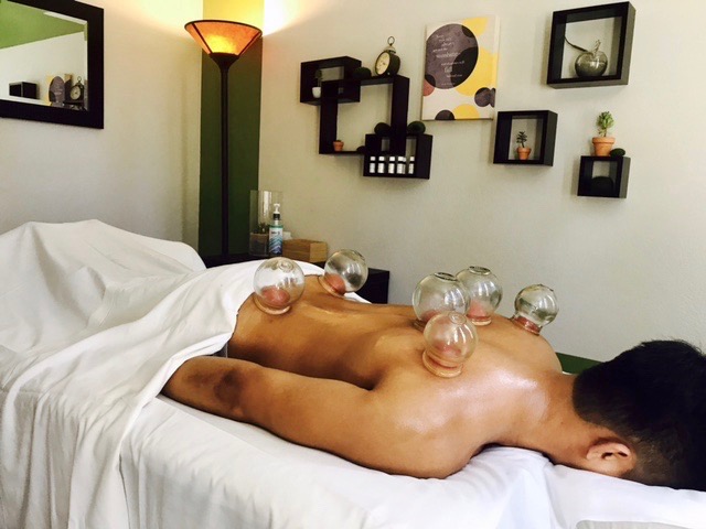 Cupping is a therapy used by acupuncturists to treat pain and other medical conditions. 